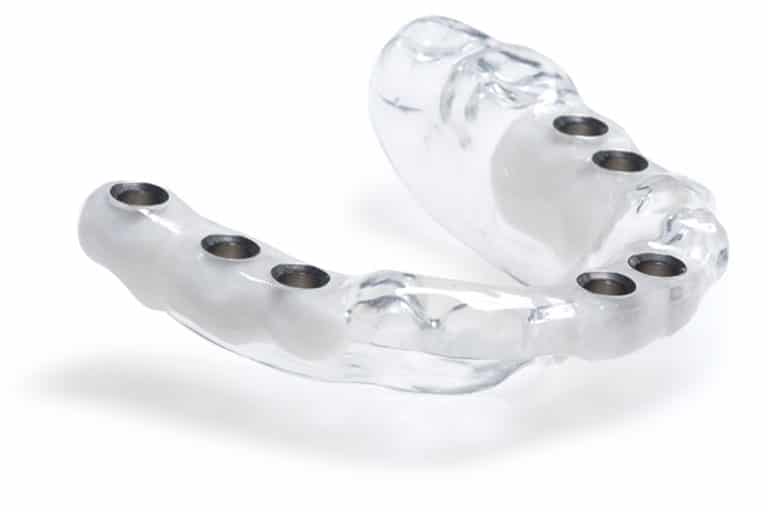 Dental implants