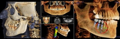 3D CT Scan